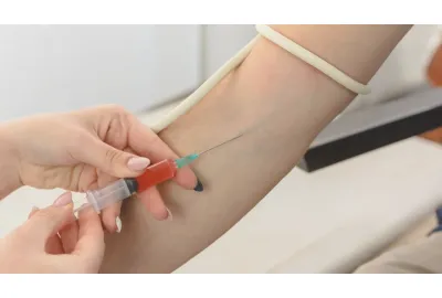 image de catheter medical