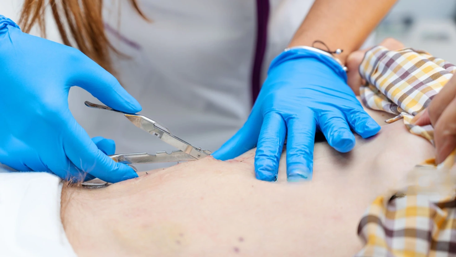 Sutures & Ligatures